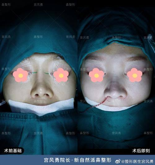 云南王的整形美容医院价格表