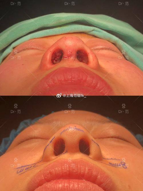 大连芳华医美门诊预约挂号方式：