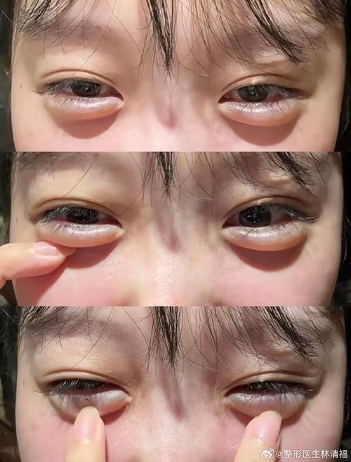 西安永缘豌豆整形医院预约挂号方式