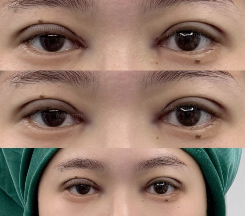 五、其他易被忽略的诱发因素