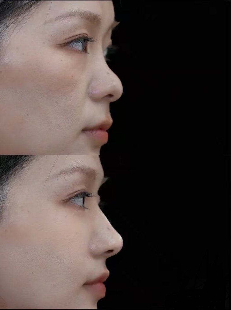 张家港第一人民医院烧伤整形科地址电话及营业时间