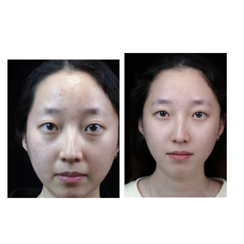 三、衰老与遗传：眼周问题的“双重枷锁”