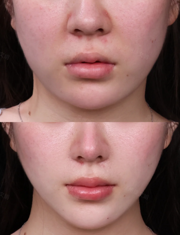 昆明璀璨人生医疗美容诊所医生名单及擅长领域：