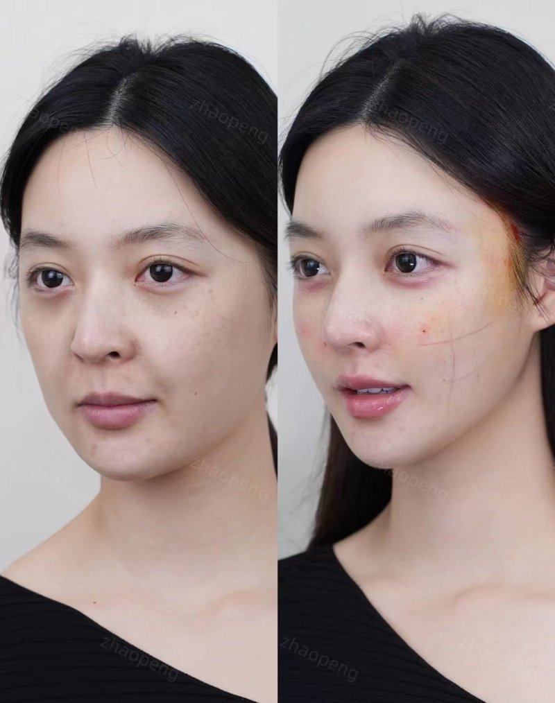 昆明璀璨人生医疗美容诊所怎么样？