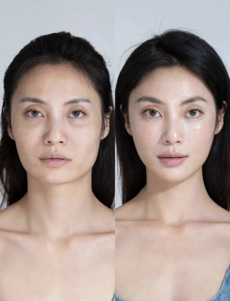 四、不同需求下，怎么选到“更好”的祛眼袋方法？