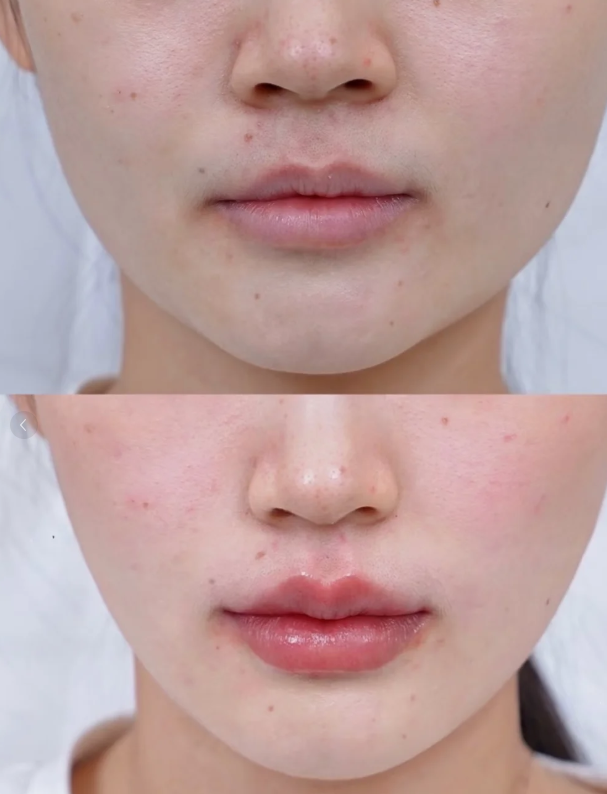 二、生活作息：眼周问题的“隐形导火索”