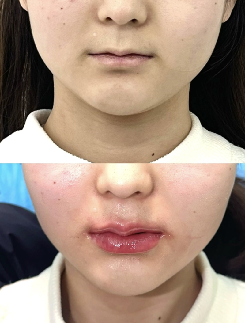 二、术后不同阶段的核心护理要点