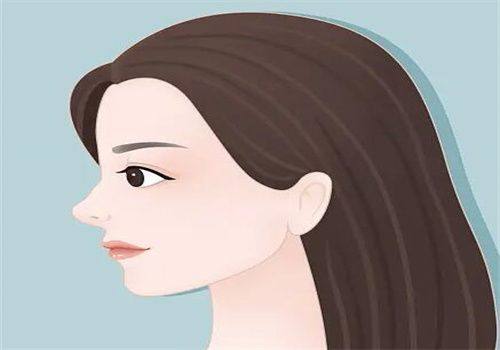 40多岁割双眼皮，成效与修复的关键因素