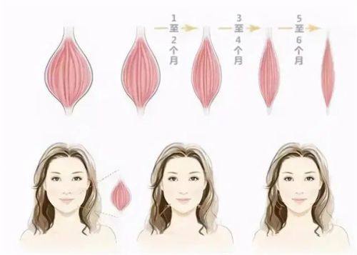 四、手术修复方案：保守无效时的硬核解决途径