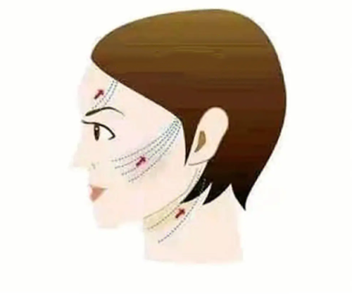 四、医美改善方案,针对性解决顽固问题