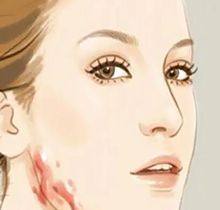 二、抽脂后不同阶段的活动参考：下床、散步与出门