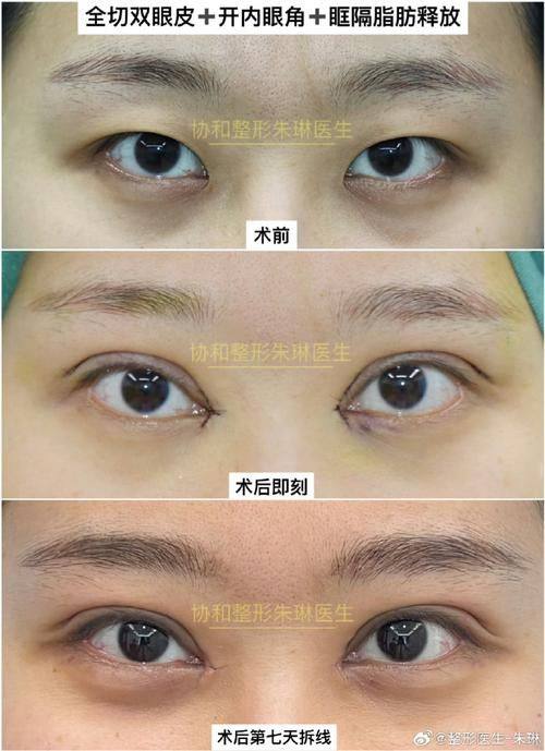 扬州莱沐医疗美容诊所擅长项目：