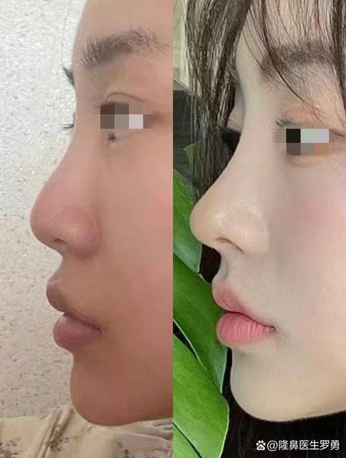 无锡伊尔美整形医院怎么样？