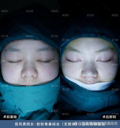 北京米扬医疗美容整形外科医院价格表：