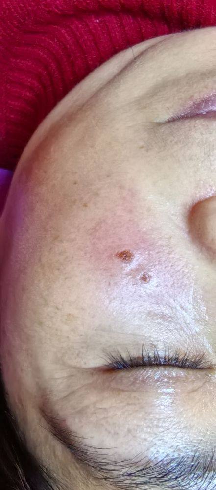 乐山市人民医院(美容整形烧伤科)预约挂号方式：