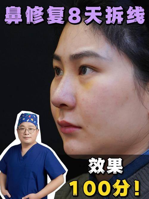 韩国Afternoon整形怎么样