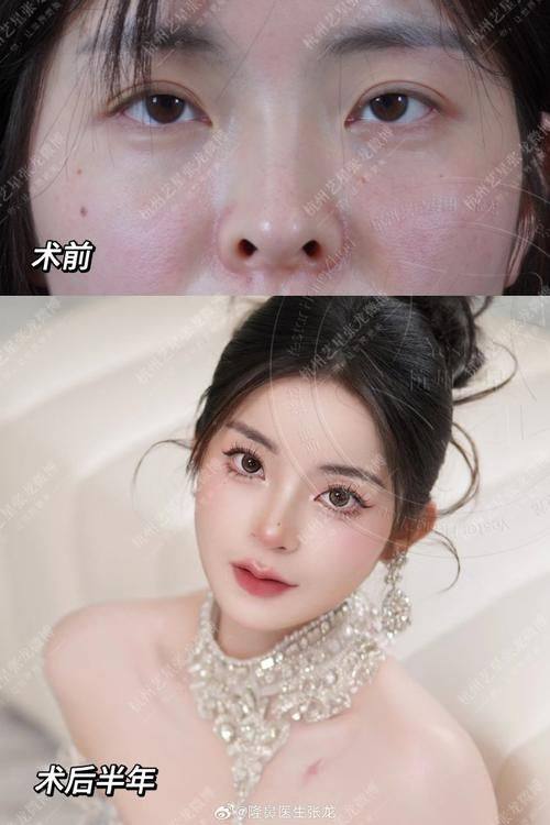 北京米扬医疗美容整形外科医院地址电话及营业时间：