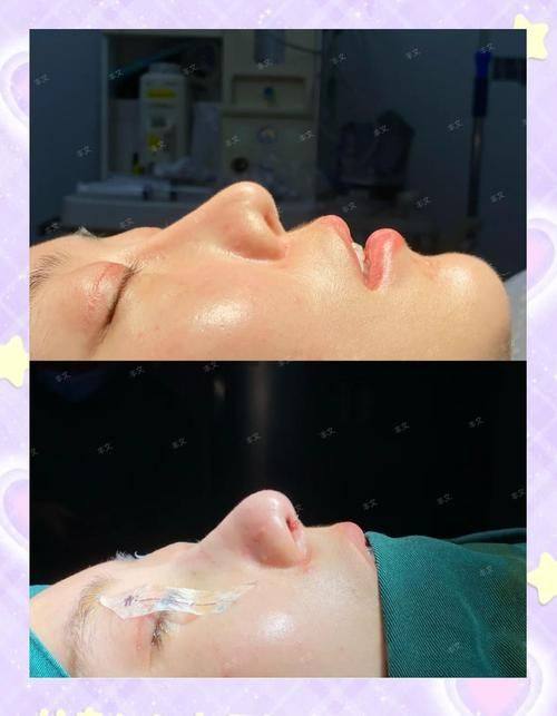 高邮吉丽生医疗美容诊所预约挂号方式