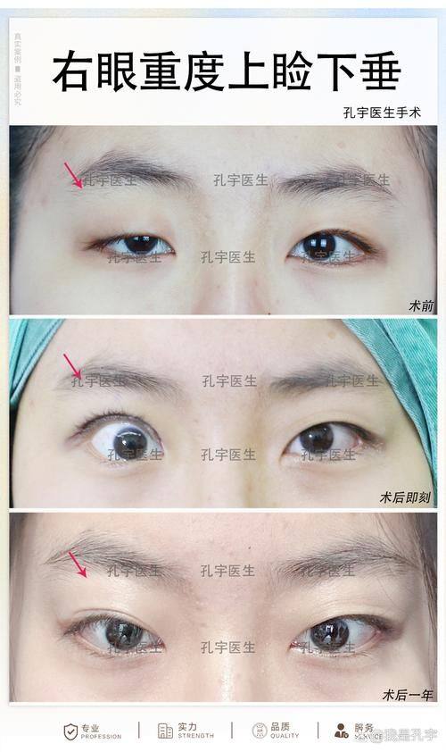 乐山市人民医院(美容整形烧伤科)价格表：