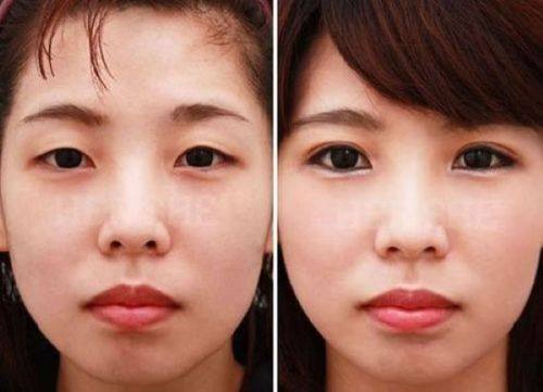 杭州悦可医疗美容诊所预约挂号方式：