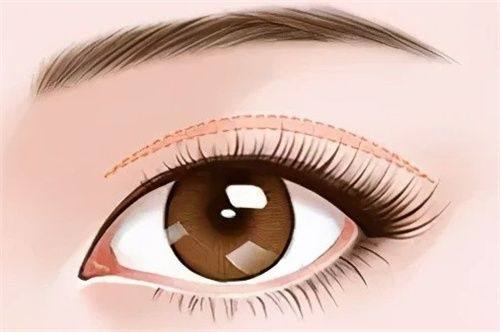 五、眼霜去眼袋的正确定位：长期辅助而非有效治疗