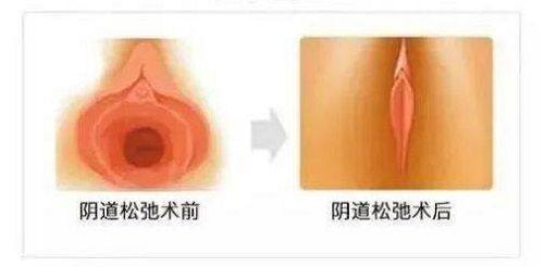 二、为什么各类眼霜对眼袋改善成效甚微