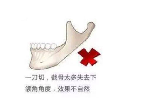四、色素疤痕修复的注意事项与医院选择