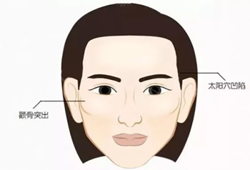 三、脸上有凹陷疤能完全修复吗