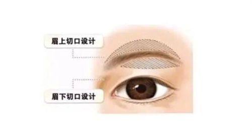 四、乳房全切重建手术：术后1-3个月是疤痕修复黄金期