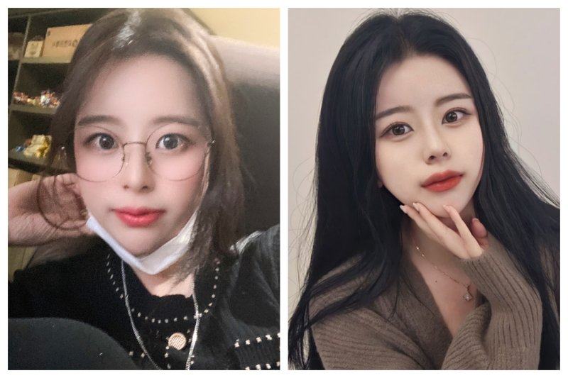 二、不同面部手术疤痕激光祛疤的核心逻辑