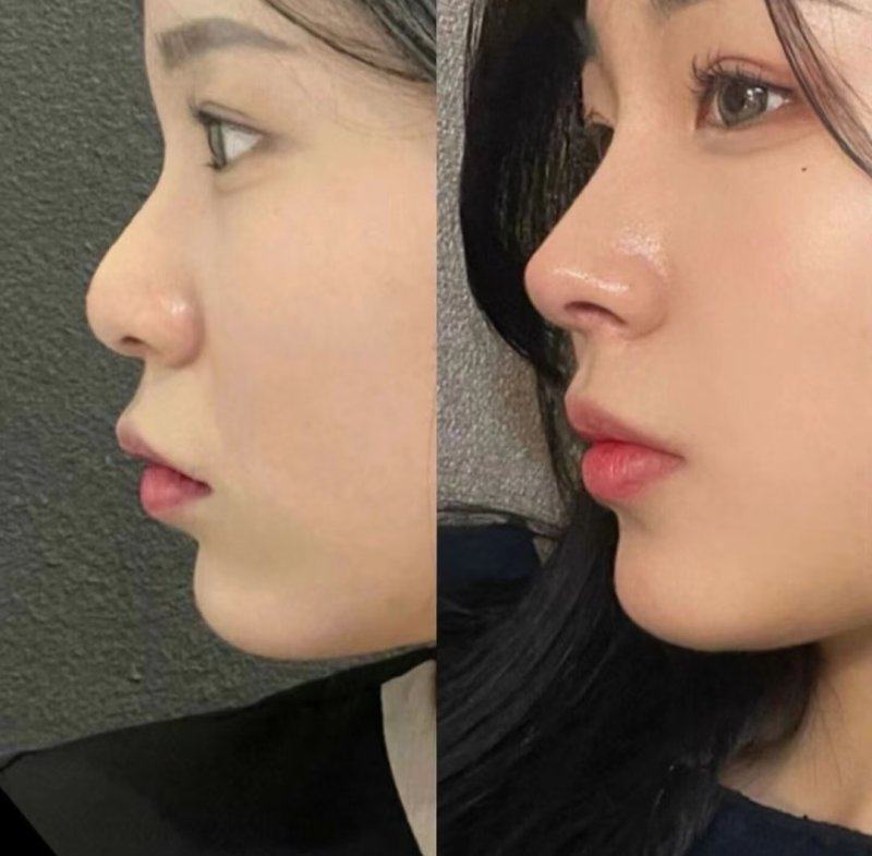 二、刀划伤口怎样愈合的快：促进愈合的关键措施