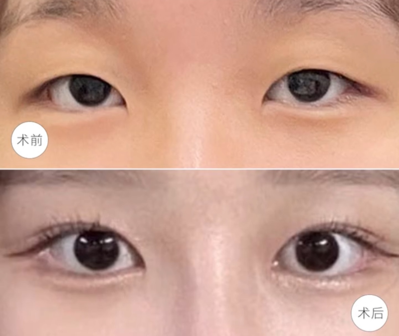 四、知乎热议：眼霜去眼袋到底管不管用