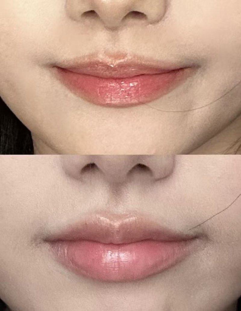 三、除掉色素疤痕的居家实用小妙招