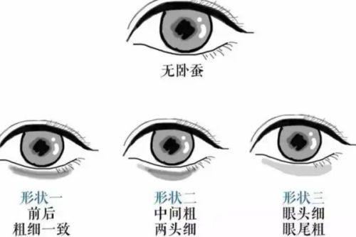 二、影响射频除皱维持时间的核心因素