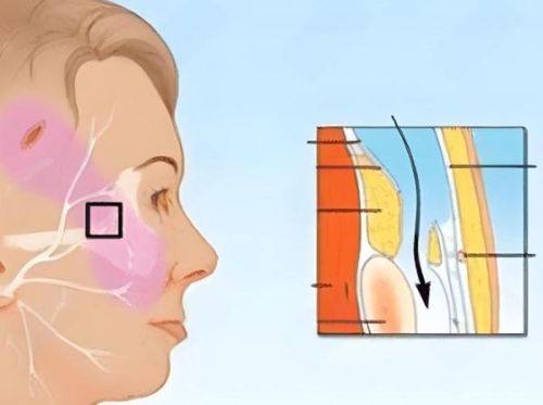五、关联问题：术后异常情况的应对