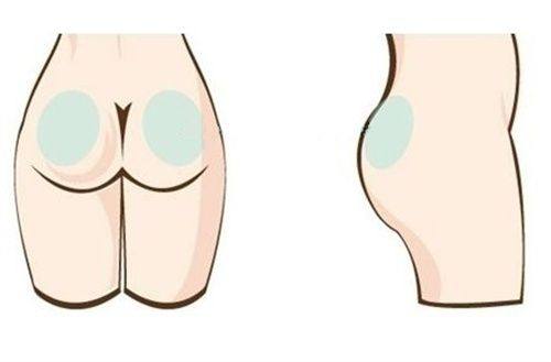 八、疤痕疙瘩萎缩怎么回事?末尾会自然萎缩吗?