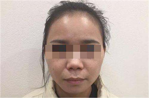 三、男士去眼袋小偏方：简单易操作的应急舒缓法