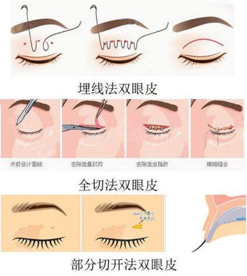 二、蜂蜜对眼周状态的真实作用