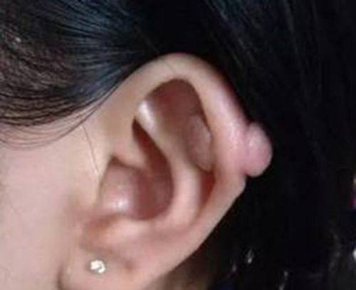 四、影响侧睡时间的关键个体差异因素