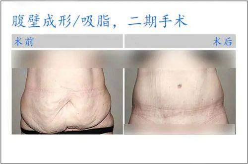 绥化肇东市人民医院口碑评价：