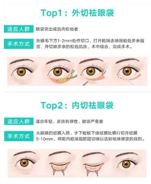 北京芊芊丽人整形美容医院价格表：