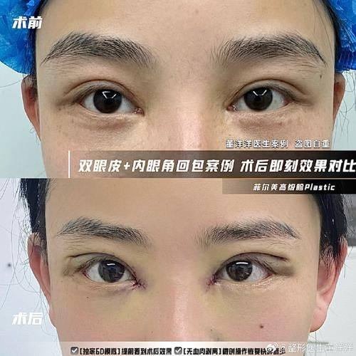 上饶芯颜整形医院地址电话及营业时间