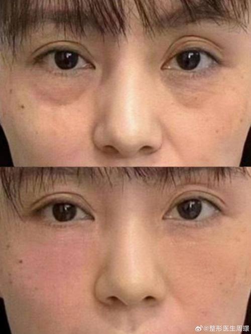 智美颜和医疗美容价格表：