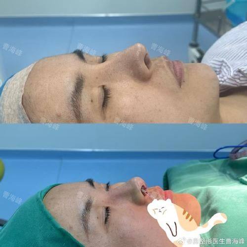 北京芊芊丽人整形美容医院怎么样？