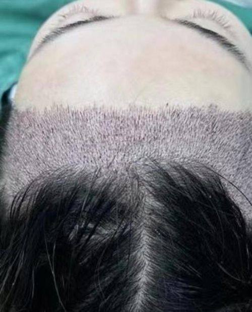 荆州霏漾医疗美容皮肤诊所怎么样？