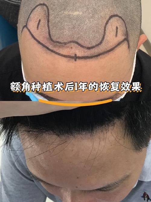 荆州霏漾医疗美容皮肤诊所预约挂号方式