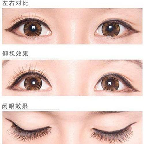 蒙自尊尚医疗美容诊所擅长项目：