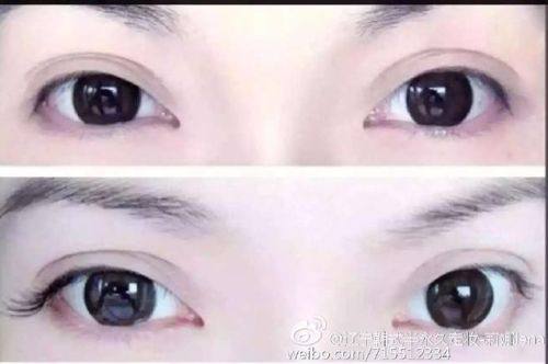 蒙自尊尚医疗美容诊所预约挂号方式