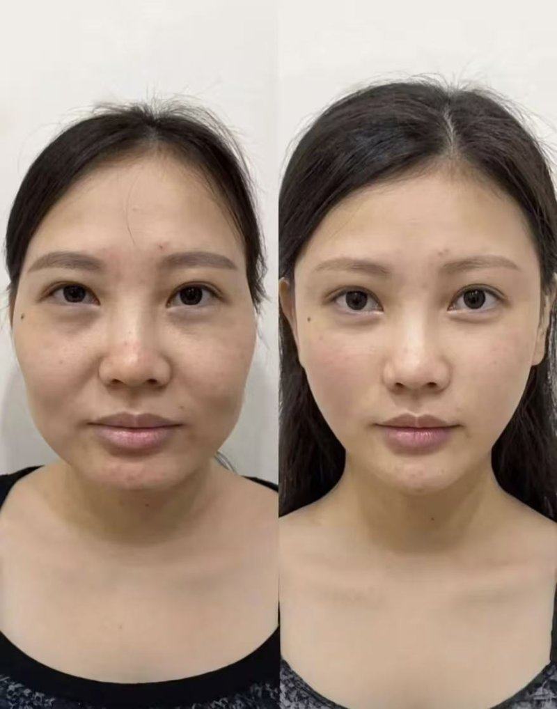 上饶芯颜整形医院口碑评价