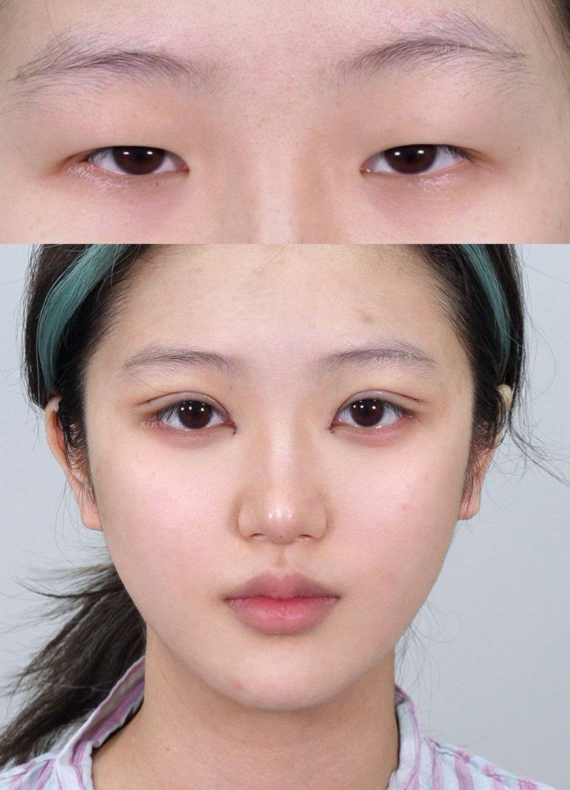 广州鸿嘉怡美医疗美容门诊部预约挂号方式